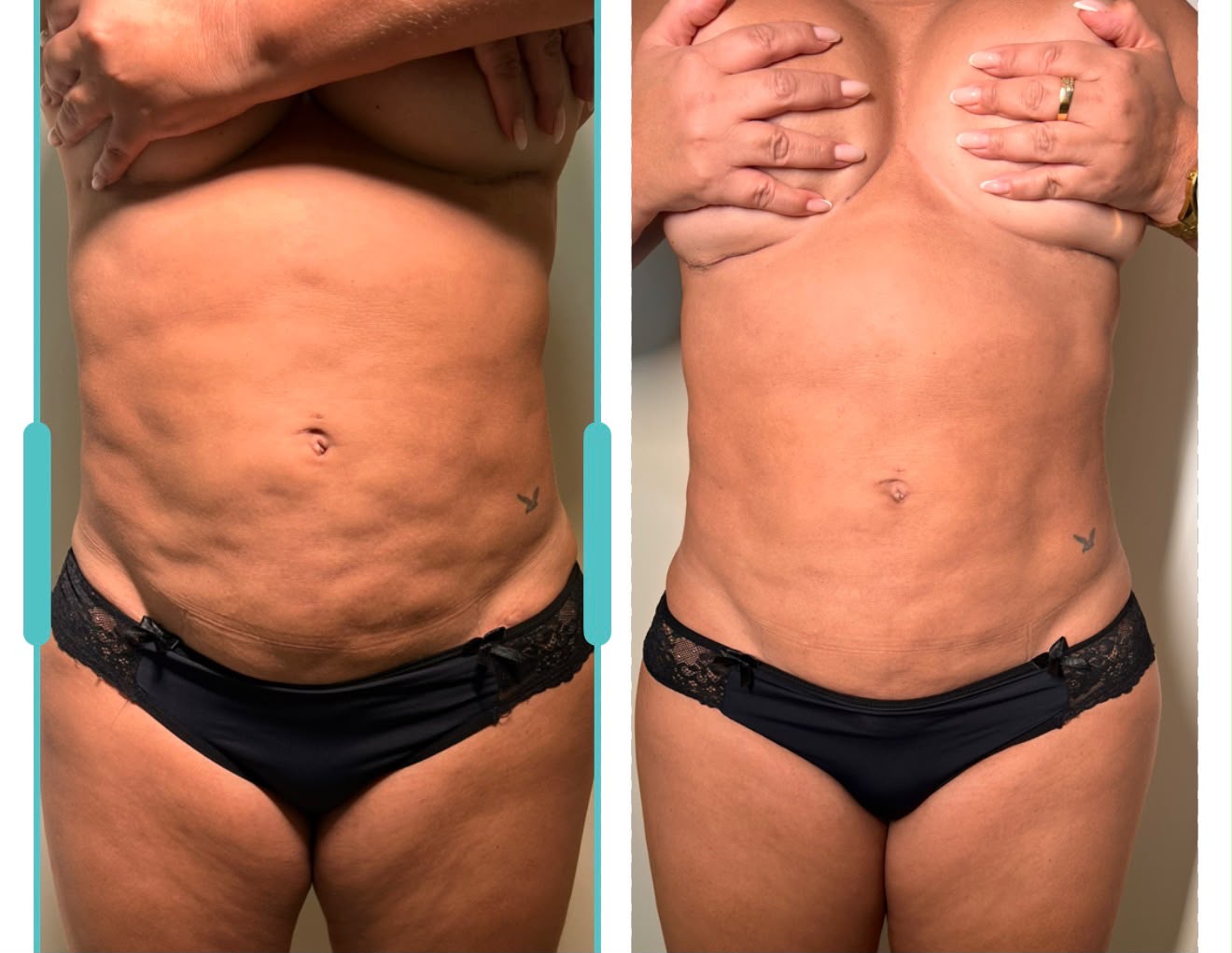 Antes e depois de condução de pós-operatório