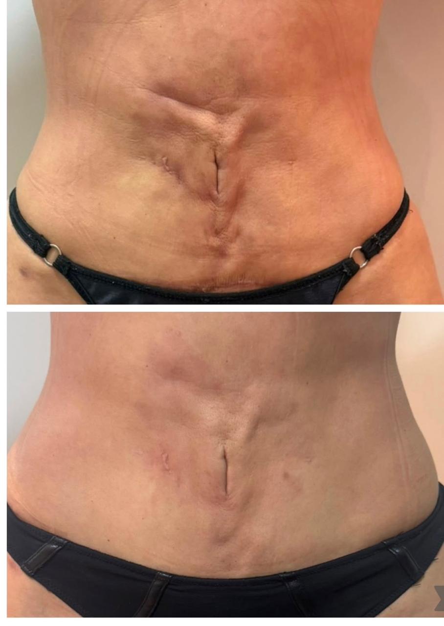 Antes e depois de condução de pós-operatório